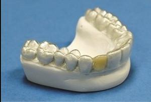 Chine Retenant dentaire stable Les dents orthodontiques Retenant professionnel clair à vendre