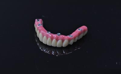 Cina Impianto di denti artificiali a carico immediato denti artificiali rimovibili rosa chiaro in vendita