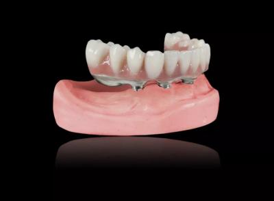 China Implantes de barras de titânio Dentaduras removíveis Barras de titânio em ligação Dentaduras excessivas à venda