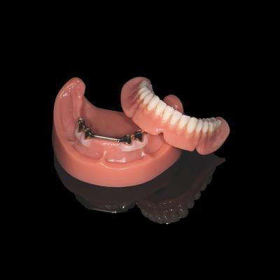 Cina Denti rimovibili a barra di titanio rosa con finitura a dentiera acrilica in vendita