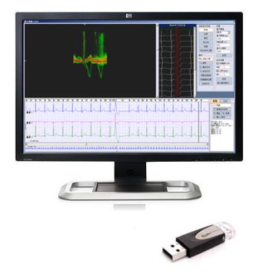 China Holter ECG Workstation W/ EKG Holter Monitor and ECG Analyzer Software iTengo OEM for sale