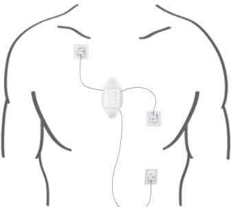 China 3-CHANNEL HOLTER MONITOR 7 DAYS HOLTER PATCH MINI SIZE NO WIRE for sale