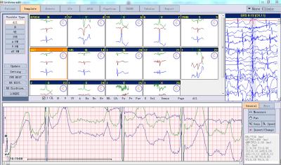 China PC Based ECG Holter Monitoring System 24 Hours Ambulatory Recording iTengo for sale