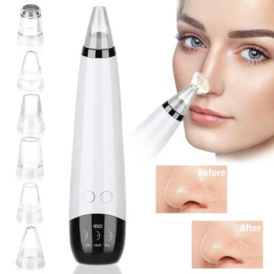 China Portable Electric Blackhead Remover Vacuum Acne Blackhead Remover AOOTOY Rise Treatment Comedone Facial Tool With LED Display for sale