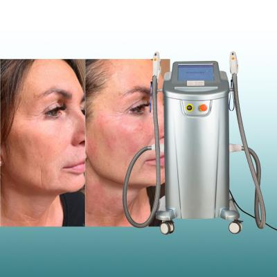 China High Quality Blood Vessel Removal Choose Professional IPL Hair Laser Removal Machine Price Hottest 3 in 1 Elight IPL SHR RF ND Yag Laser Tattoo Removal for sale