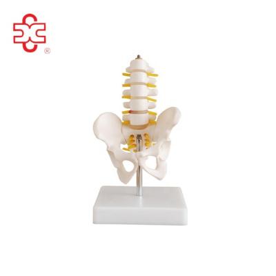 China Reduced Half Spine Lumbar Vertebrae with Sacrum and Coccyx and Herniated Disc Lumbar Spine XC-119A for sale