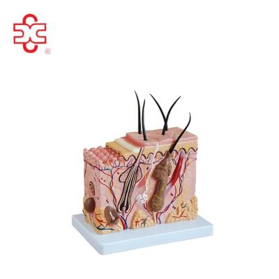 China Teaching Medical Plastic Skin Block Model for sale