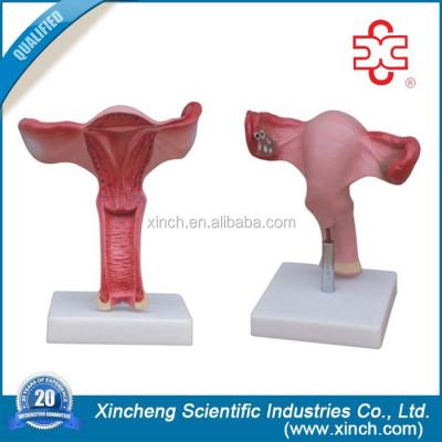 China PVC Magnified Womb Female Reproductive System Model for sale