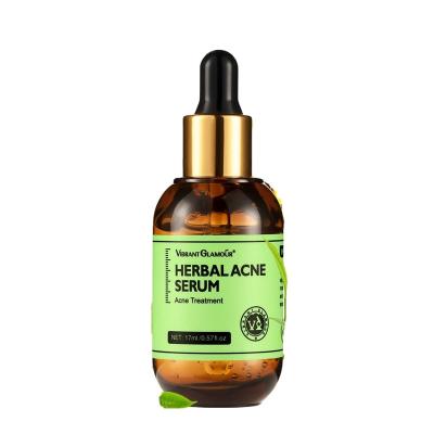 China Nourish Brightening Acne Night Oil Herbal Control Serum Treatment Acne Whitening Shrink Pores Remove Scars Scars Skin Care 17ml for sale