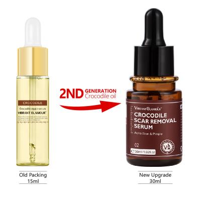 China Overnight Crocodile Scar Repair Serum Acne Treatment Stretch Mark Removal Acne Scars Whitening Spots Skin Care 30ml for sale