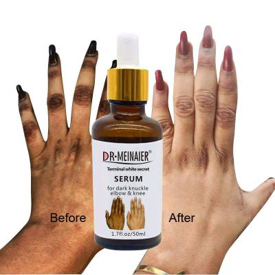 China Safe Hand Brightening Joint Elbow Knee Whitening Serum 30ml To Remove Melanin for sale