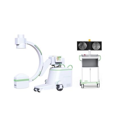 China High Frequency Cheap Metal Camera Medical Operation C-arm Fluoroscopy Machine for sale