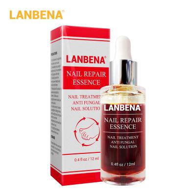 China LANBENA Nail Repair Essence Serum Nail DEEP CLEANSING Fungal Treatment Remove Onychomycosis Toe Nourishing Brighten Hand Foot Skin Care 12ml for sale