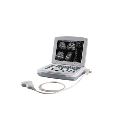 China BT-UD580 12 Inch Metal B/W Cheap Medical Portable Ultrasound Machine With Convex Probe Trans-vaginal Probe Price for sale