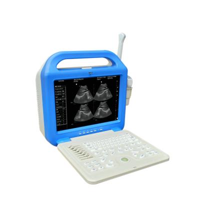 China BT-UD005 hospital medical equipment plastic cheap table top ultrasound scanner/ultrasonic diagnostic system for human and animal price for sale