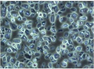 China Zusammengesetzter biologischer besonders langer Arbeitsabstand Kondensator Na 0,3 Mikroskop-ELWD zu verkaufen