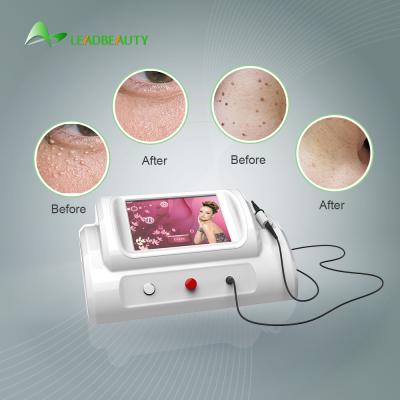 China 30Mhz high frequency Spider Vein removal price / using for vascular removal with 8.4 inch screen /150W skin tag removal for sale