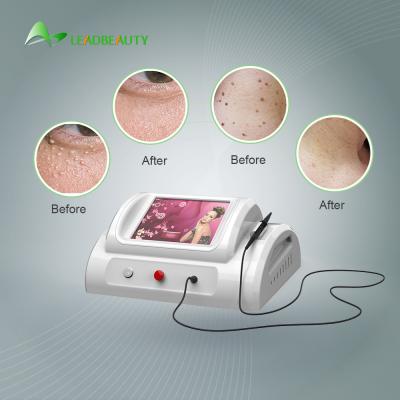 China 30Mhz high frequency Spider Vein removal price / using for vascular removal with 8.4 inch screen /150W skin tag removal for sale