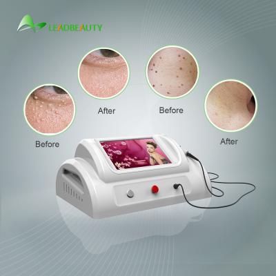 China 30Mhz high frequency Spider Vein removal price / using for vascular removal with 8.4 inch screen /150W skin tag removal for sale