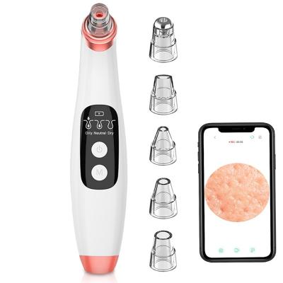 China 2021 Hot Selling Acne Treatment Blackhead Visible Remover With Camera for sale