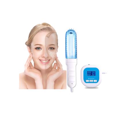 China Plastic High Quality Durable Handheld Home Use 311nm UVB Lamp For Vitiligo Psoriasis for sale