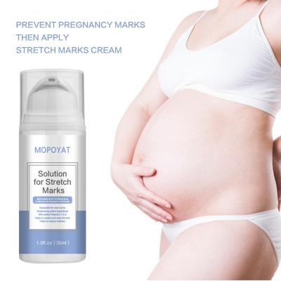 China Skin Revitalizer Organic Stretch Mark Repair Skin Treatment Scar Stretch Mark Removal Cream Smooth Cream For Female for sale