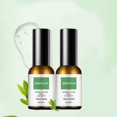 China Wholesale Pure Nature Extract OEM ODM 30ml Herbal Face Serum Moisturizer Private Label Best For Pimples And Acne for sale