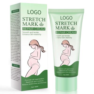 China Amazon Top Sale 60g Nourishing Cream Herbal Stretch Mark Treatment For Anti Stretch Marks Cream OEM/ODM for sale