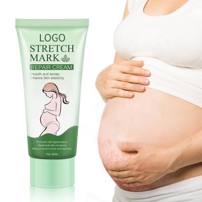 China Best Anti Stretch Mark Skin Revitalizer Cream Private Label Repair Stretch Mark Cream High Quality for sale