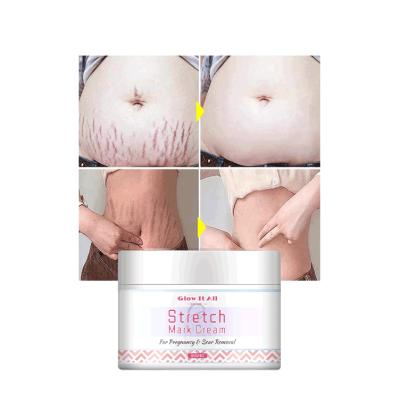 China Cantik Nourishing All Natural Mark Cream Shea Butter Cream Anti Stretch Mark Removal Cream Highly Effective for sale