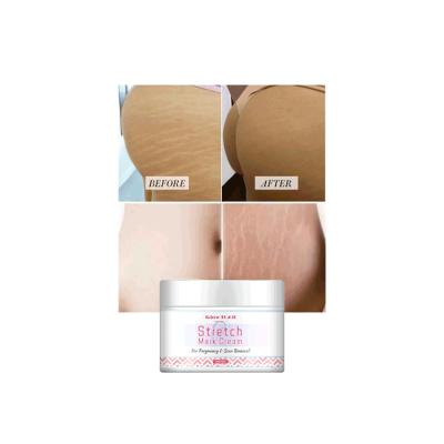 China OEM ODM Body Skin Care Skin Nourishing Repair Remove Clear Stretch Mark Cream Customize Own Logo Pregnancy Scar Removal for sale