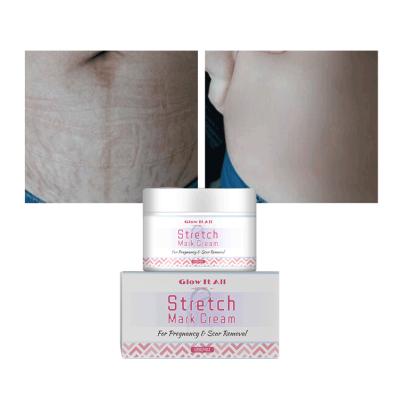 China OEM ODM Stretch Mark Skin Care Nourishing Wrinkle Anti Carboxytherapy Anti Aging For Stretch Marks Removal Cream for sale