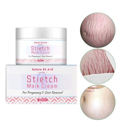 China OEM Pregnancy Scar Nourishing Cream Stretch Mark Cream / Odm Mango Stretch Mark Removal Cream Skin Whitening for sale