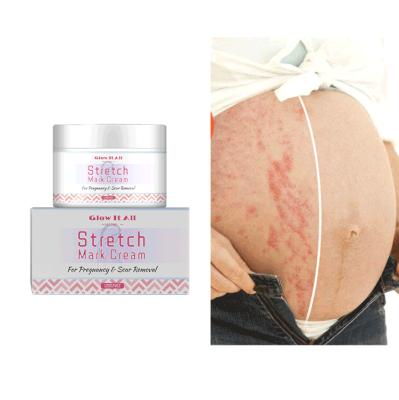 China Wholesale Nourishing Private Label Removal Scar Cream Stretch Marks Treatment Body Care Whitening Illuminating Extent Mark Skincare for sale