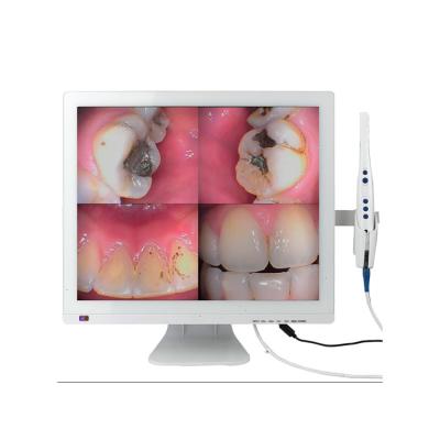 China Factory Price Metal 17 Inch Monitor Dental Intraoral Endoscope USB Oral Camera for sale