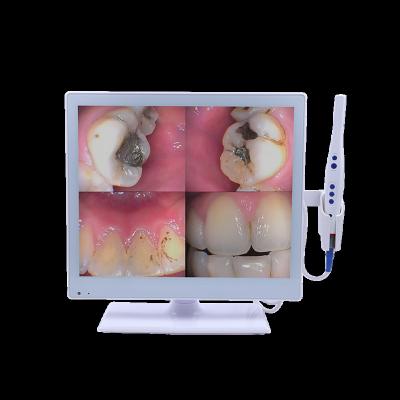 China M-978V Plastic Oral Intra Camera With 17 Inch Self-Contained Monitor for sale