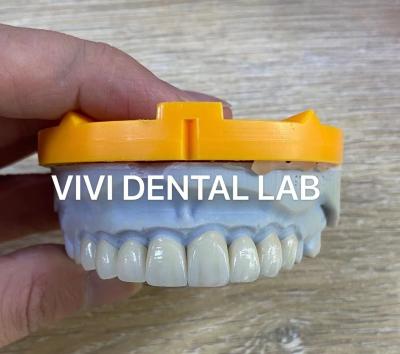 China A estratificação de Ivoclar Emax folheia o laboratório dental de nível elevado profissional translúcido de China à venda