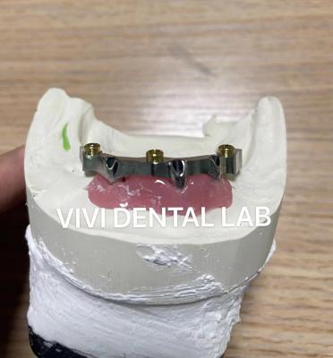 China Implant Locator Bar Overdenture Sheftner Ivoclar Vertex Titanium for sale