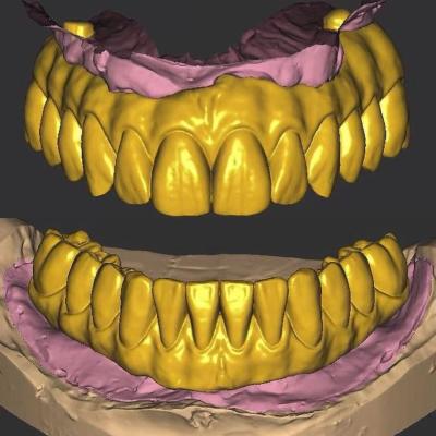 China 3 Shape Dental Crown Design / Exocad Implant Design ISO Approved for sale