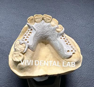 China CE dental del marco ISO de la ojeada del laboratorio parcial ISO del CE y del FDA China y FDA en venta