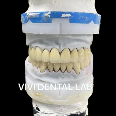 China Digitale CAD CAM tandheelkundige lab kronen doorzichtige gelaagde Zirconia kroon Te koop