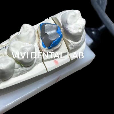 China Pista dental de metal y corona de núcleo con retención precisa en venta