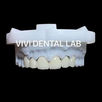 China Layered Dental Zirconia Crown And Bridge Translucency 3D PRO for sale