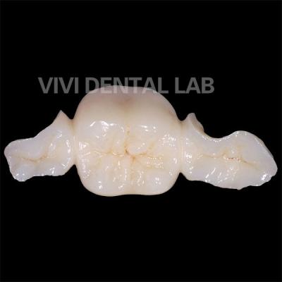 Cina Denti dentali Zirconia Maryland Bridge Alta estetica Certificato FDA in vendita