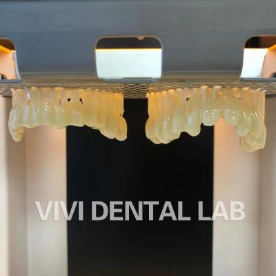 China Provisional Shell Dental Lab Crowns Teeth PMMA Temporary Crown for sale