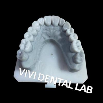 Chine Une couronne dentaire stable, une cire diagnostique pour le traitement orthodontique à vendre