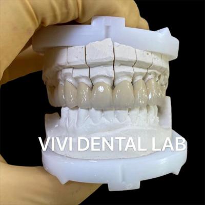 China Precise Dental Lab Crowns Esthetic Porcelain Zirconia Tooth Crown for sale