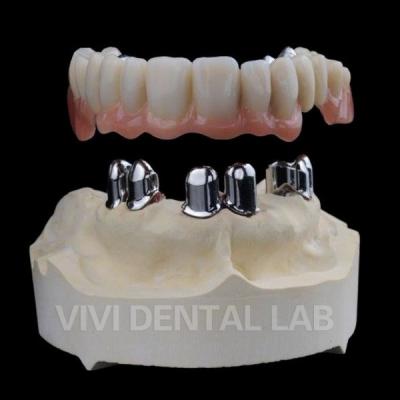 China Telescopic Dental Lab Crowns High Accuracy For Older People for sale