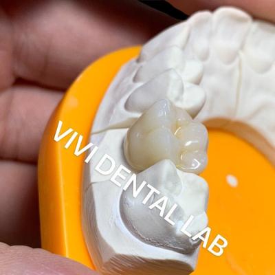 China Solid Dental Lab Crowns 3D Pro High Translucency Full Zirconia Crowns China Dental Lab for sale