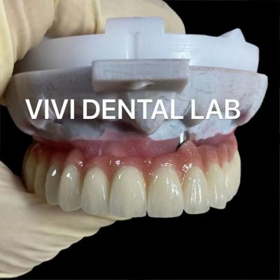 China Scheftner Ivoclar Porcelain Fused Metal Crowns Dental SLM Technique for sale